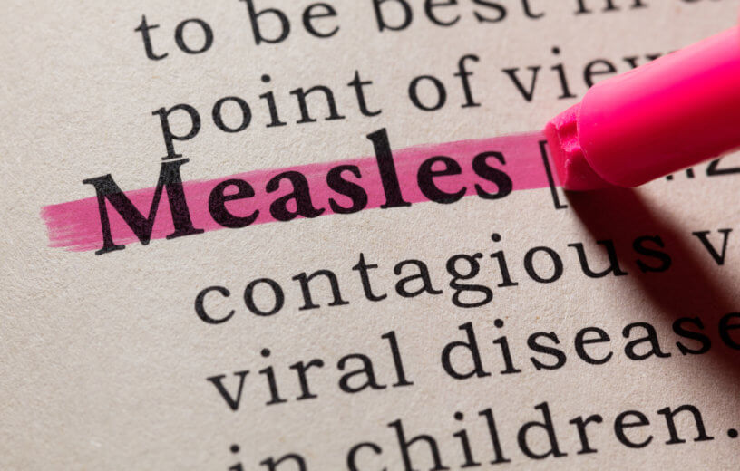 measles image